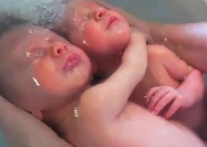 bebes-recien_nacidos-gemelos-insolito-amor-historia_ECMIMA20131115_0080_42