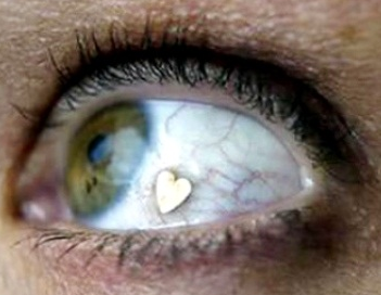 La arriesgada y extraña moda de implantarse joyas en los ojos