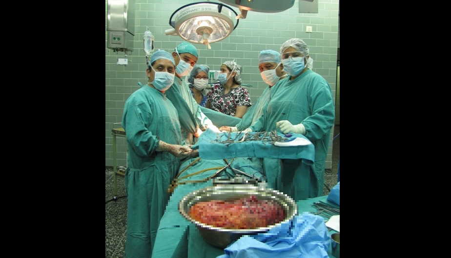 Huancayo: Mujer tenía tumor de 7 kilos en uno de sus riñones