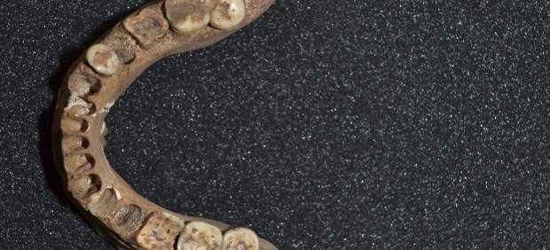 Unas caries de hace más de 13.000 años ofrecen nuevas respuestas sobre nuestro pasado
