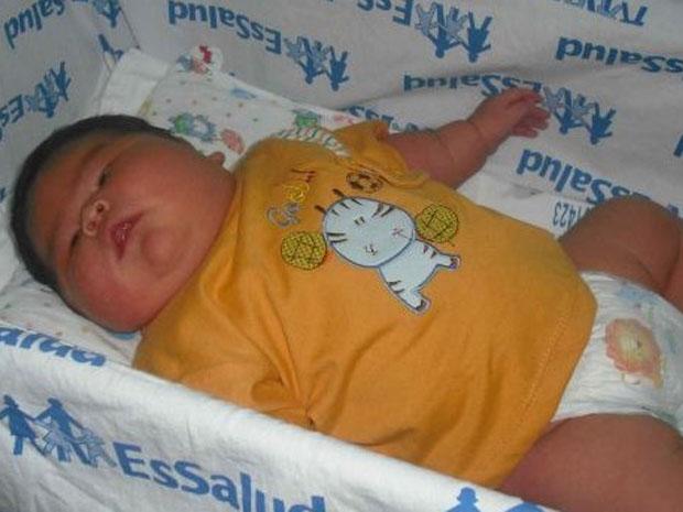 PERÚ : Nace superbebé en Iquitos y sorprende a médicos