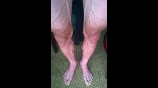 Así son las piernas de un ciclista tras 18 etapas de tour