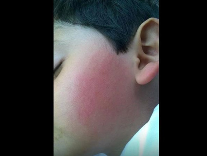 Maestra de kinder golpea a niño de 4 años y le revienta su oído