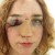Joven mujer expone brutal ataque machista con una selfie