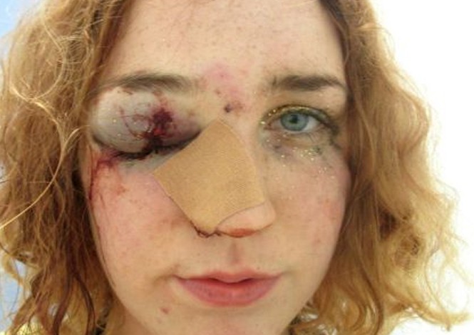 Joven mujer expone brutal ataque machista con una selfie