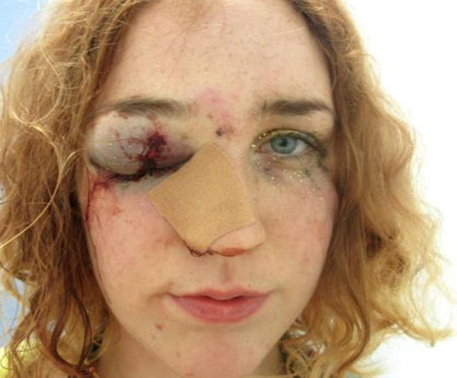 Mary Brandon fue golpeada por un hombre, luego de confrontarlo por haberla tocado. FOTO: Facebook 