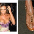 Victoria Beckham por supuesto. Esta cantante ha tenido tantos problemas por querer usar siempre zapatos de tacón tan altos que, hace algunos meses, se reportó que sufre de juanetes.