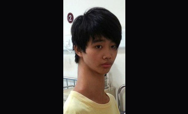 FOTOS: Conoce al joven que conmociona China con inusual tamaño de su cuello