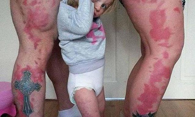 Padres se tatuaron manchas de su hija para que no sea discriminada