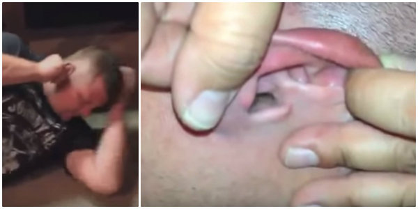 VÍDEO: le ayudaron a limpiar la oreja y lo que hallaron los dejó en shock