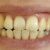 Tengo los dientes amarillos, ¿qué estoy haciendo mal?